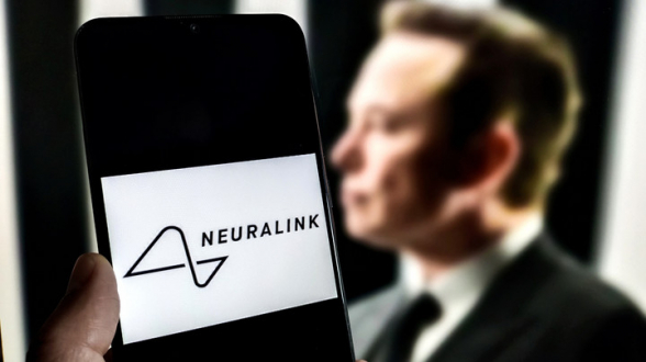 «Neuralink» получила разрешение на исследования с мозговым имплантом